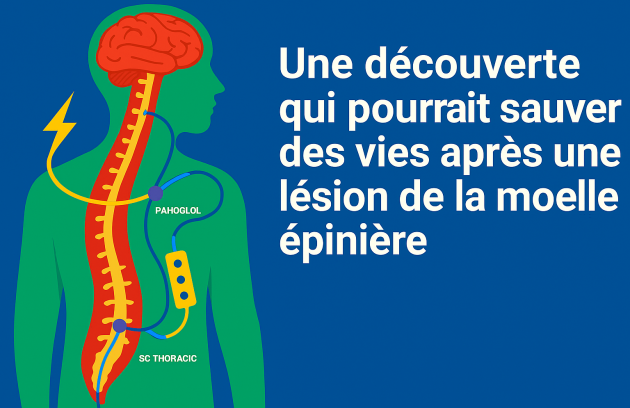 lésion médullaire - neuro-concept