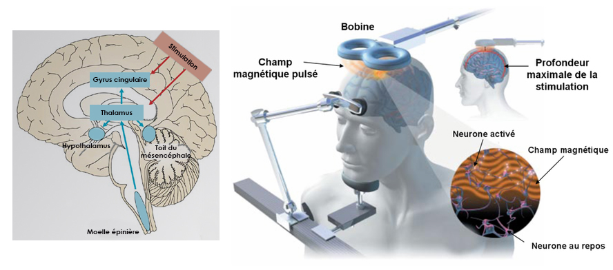neuro-concept