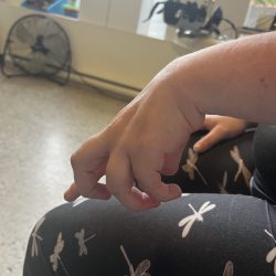 réadpatation neuro spasticité doigts